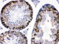 Anti-Stathmin 1 Picoband Antibody